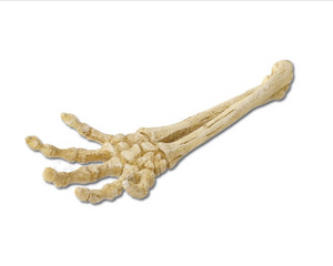 Skelett Arm